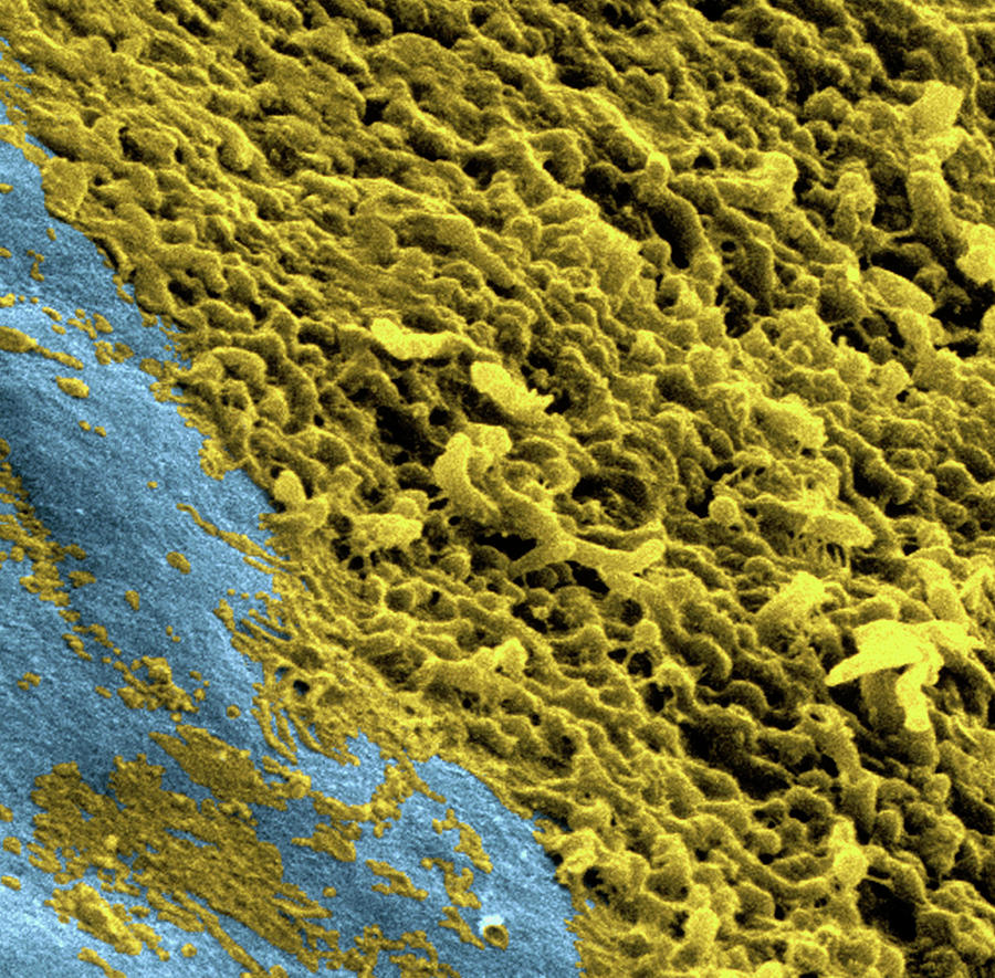 Coloured Sem Of A Dental Plaque Seen On A Tooth #1 Photograph by Dr Tony Brain/science Photo Library