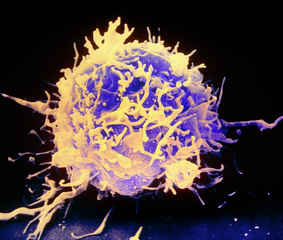 Coloured Sem Of A Tlymphocyte White Blood Cell Photograph