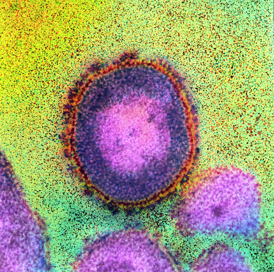 Coloured Tem Of An Hiv Virus #1 Photograph by Nibsc/science Photo Library