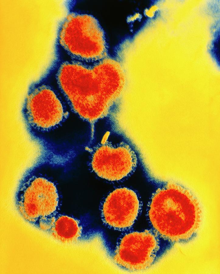 Coloured Tem Of Beijing Influenza Viruses Photograph By Nibsc Science