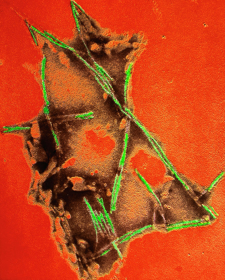 Coloured Tem Of Brain Fibrils In Mad Cow Disease #1 Photograph by Em Unit, Vla/science Photo Library