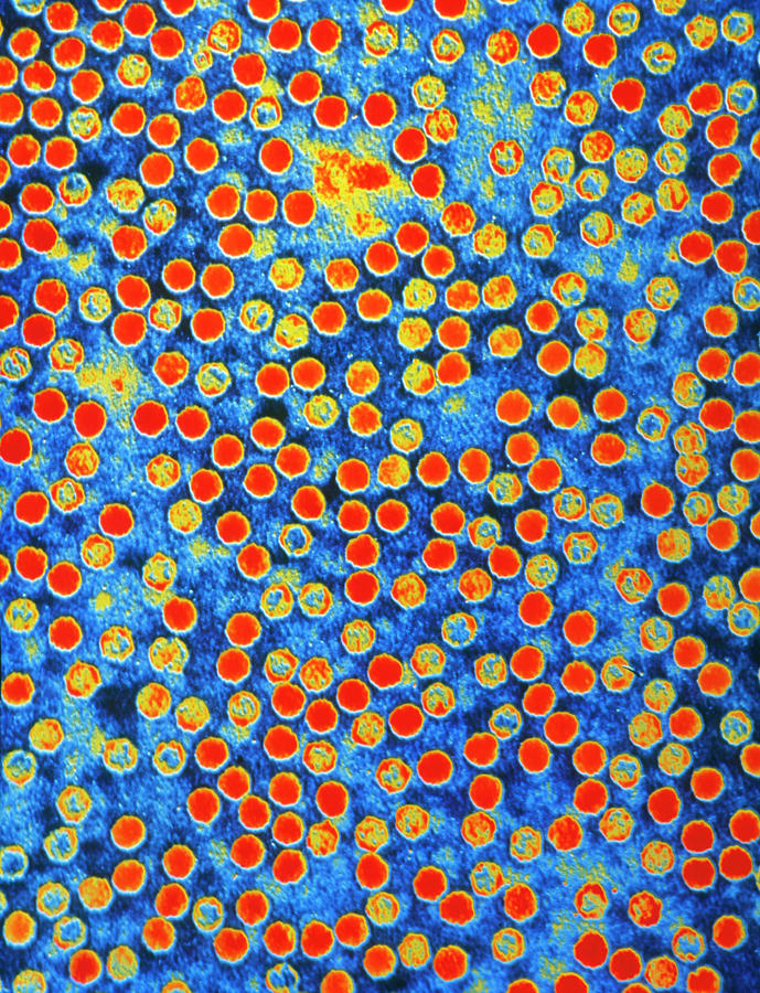 Polio Virus Photograph - Coloured Tem Of Polio Virus Virions #1 by A.b. Dowsett/science Photo Library