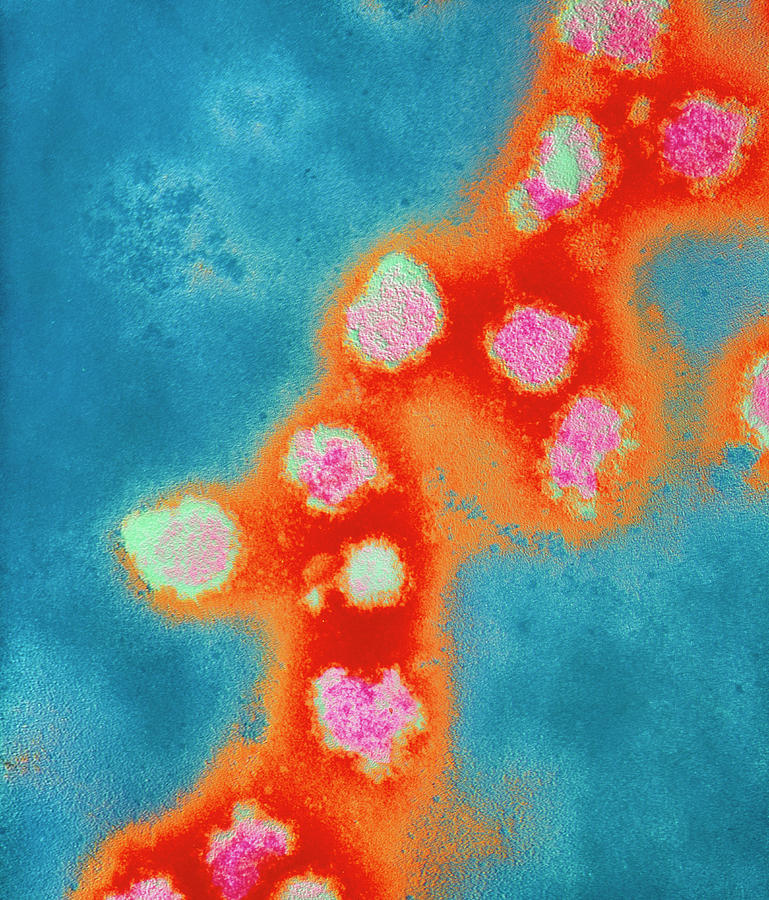 Rubella Virus Photograph - Coloured Tem Of Rubella Virus Particles #1 by Nibsc/science Photo Library