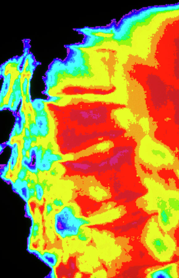 Coloured X-ray Of Osteoporosis Of The Spine Photograph by Cnri/science ...