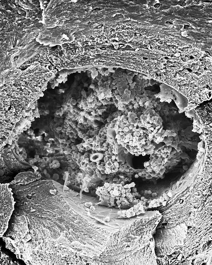 Compact Bone And Bone Marrow #1 Photograph by Dennis Kunkel Microscopy/science Photo Library
