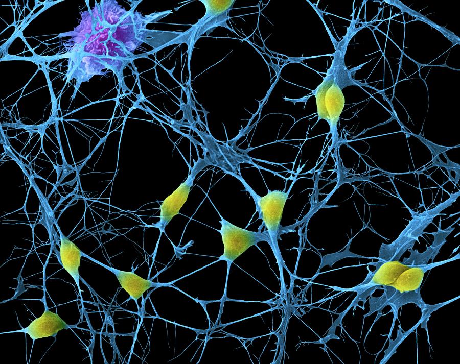 Cortical Neurons #1 Photograph by Dennis Kunkel Microscopy/science Photo Library