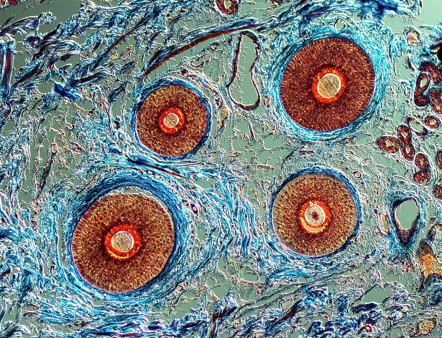 Arrector Pili Muscle Photograph - Cross-section Through Human Hairs #1 by Alfred Pasieka