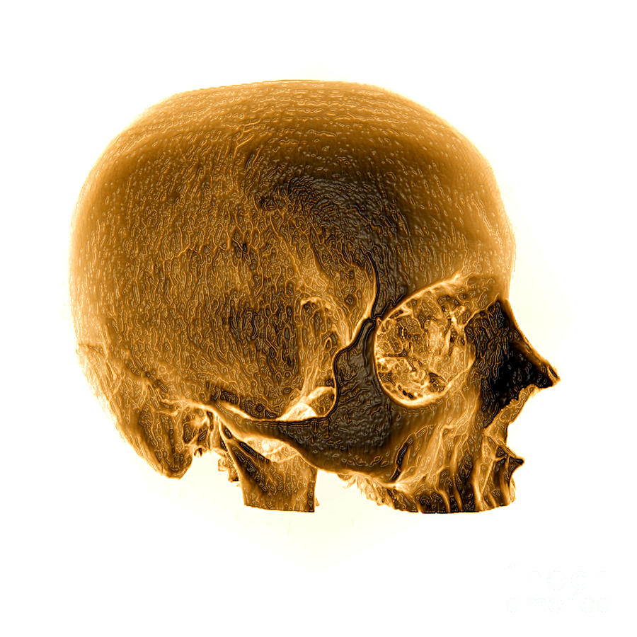 Ct Reconstruction Of Skull #1 Photograph by Living Art Enterprises, LLC
