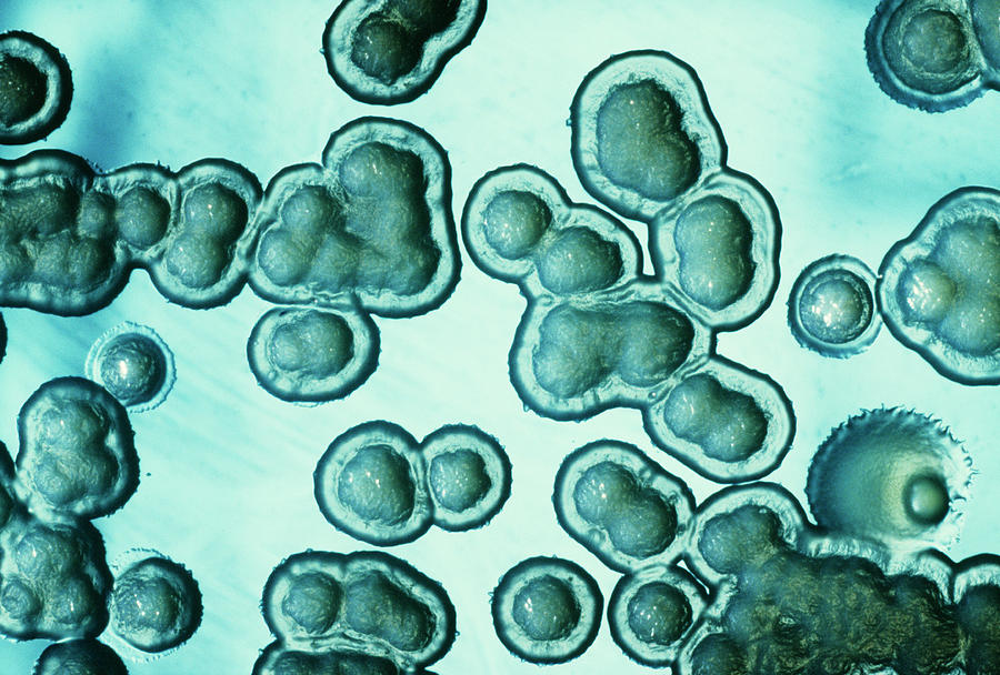 Cultured Pseudomonas Bacteria #1 Photograph by Cnri/science Photo Library