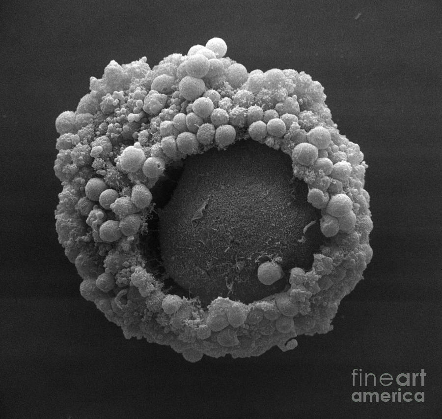 Cumulus Oophorus Cells #1 Photograph by David M. Phillips