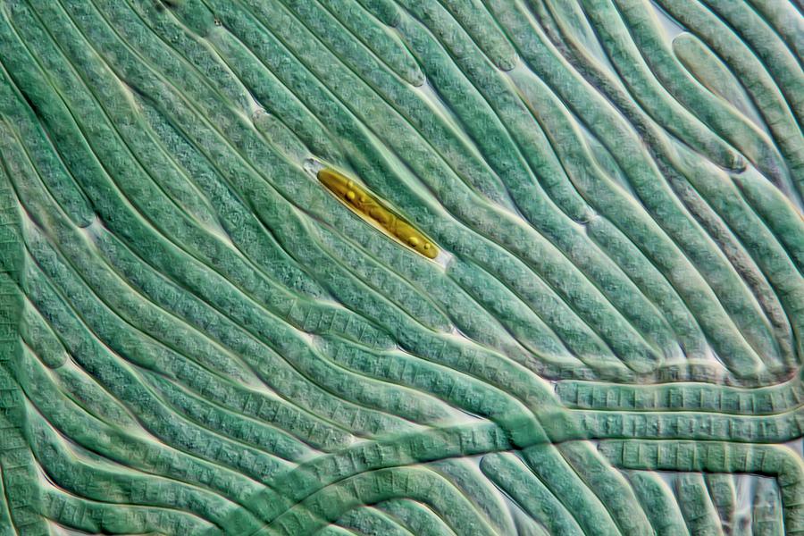 Cyanobacteria And Diatom #1 Photograph by Gerd Guenther