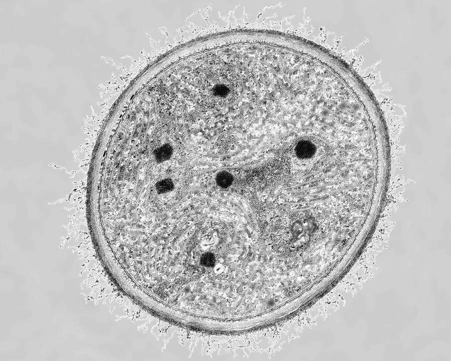 Cyanobacterium (dermocarpa Sp.) #1 Photograph by Dennis Kunkel Microscopy/science Photo Library