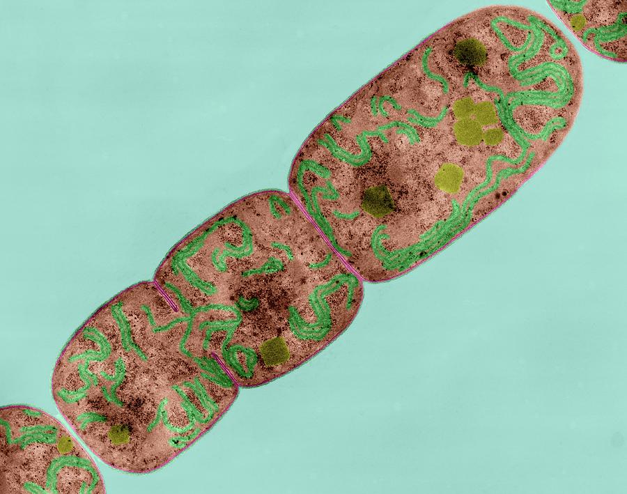 Cyanobacterium (nostoc Sp.) #1 Photograph by Dennis Kunkel Microscopy/science Photo Library