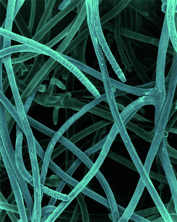 Cyanobacterium (scytonema Sp.) #1 Photograph by Dennis Kunkel Microscopy/science Photo Library