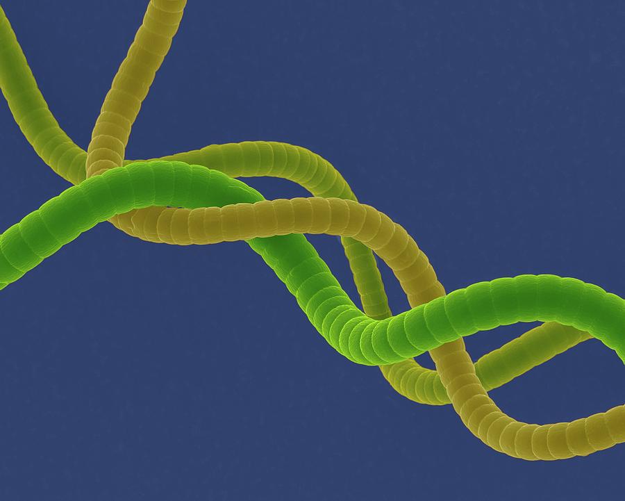 Cyanobacterium (spirulina Platensis) #1 Photograph by Dennis Kunkel Microscopy/science Photo Library