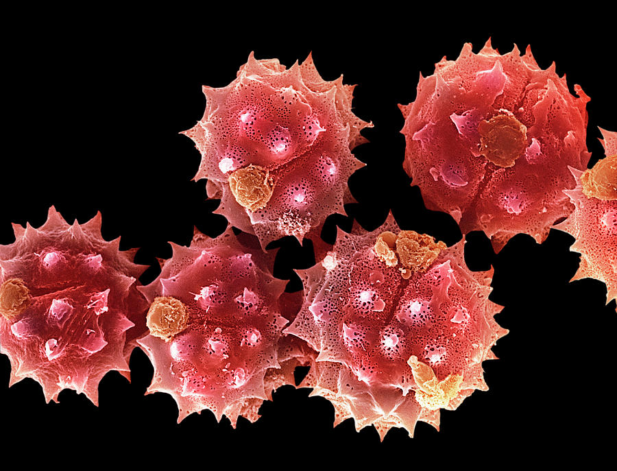 Пыль пыльца. Пыльца коронавирус под микроскопом. Цветочная пыльца под микроскопом. Пыльца растений под микроскопом. Пыльца амброзии под микроскопом.