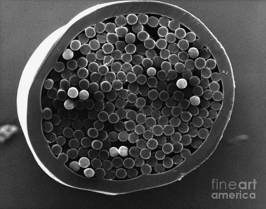 Dalkon Shield Iud Tailstring Sem #1 Photograph by David M. Phillips / The Population Council