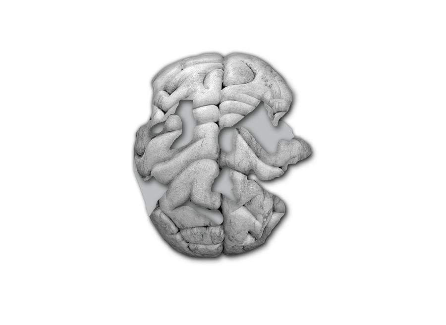 Illustration Photograph - Damaged Human Brain #1 by Victor De Schwanberg