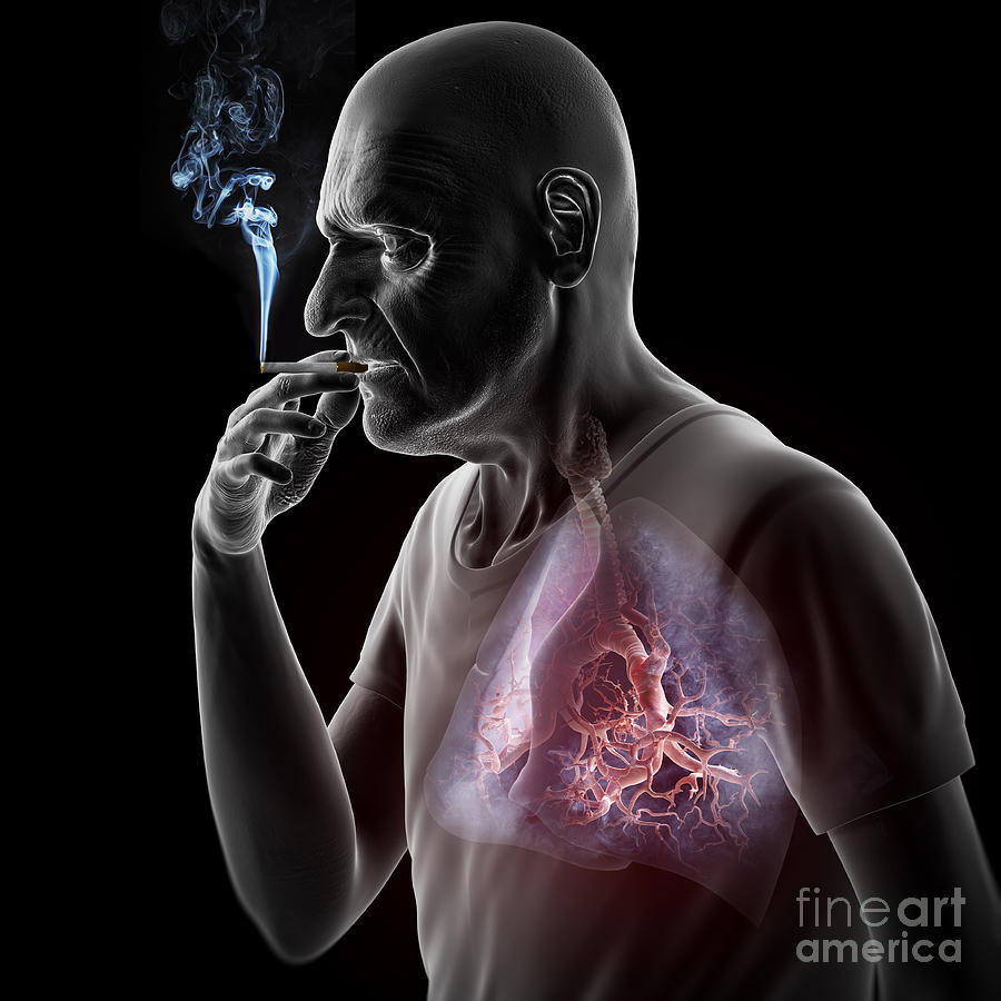Dangers Of Smoking #1 Photograph by Science Picture Co
