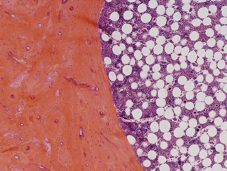 Decalcified Bone Cross Section Lm Photograph By Science Stock Photography