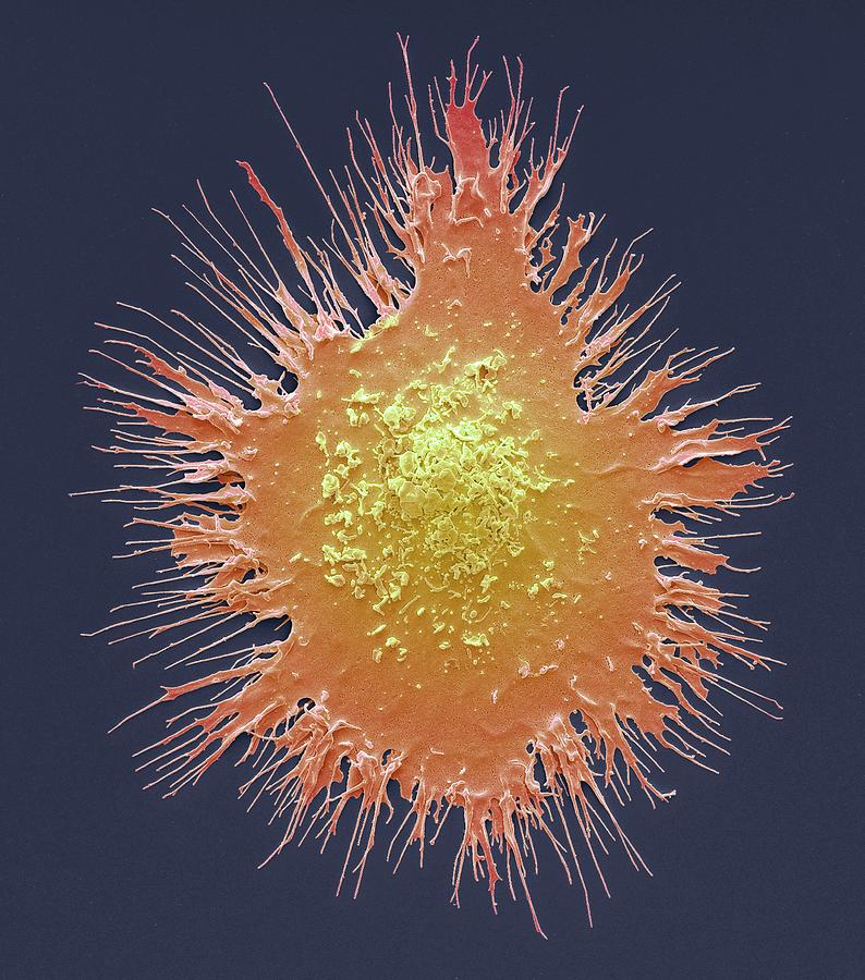 Anatomical Photograph - Dendritic Cell #1 by Steve Gschmeissner