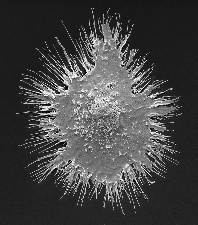 Black And White Photograph - Dendritic Cell #1 by Steve Gschmeissner/science Photo Library