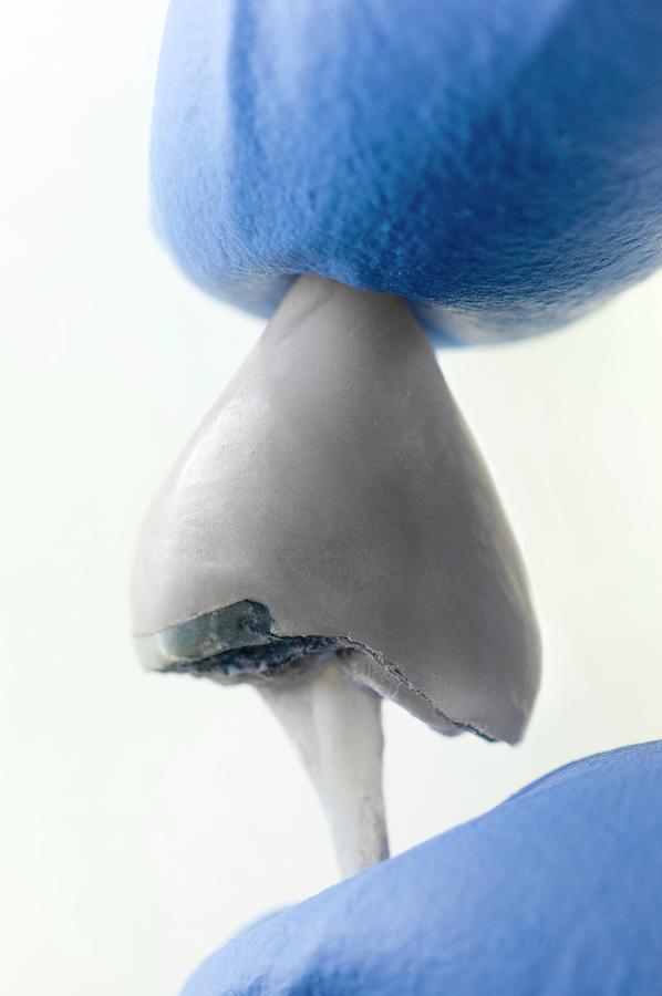 Detached Dental Crown For A Canine Tooth Photograph by Dr Jeremy ...