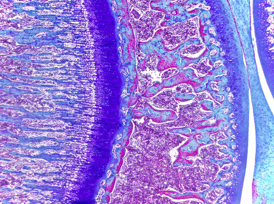 Developing Bone Lm #4 Photograph by Alvin Telser - Pixels