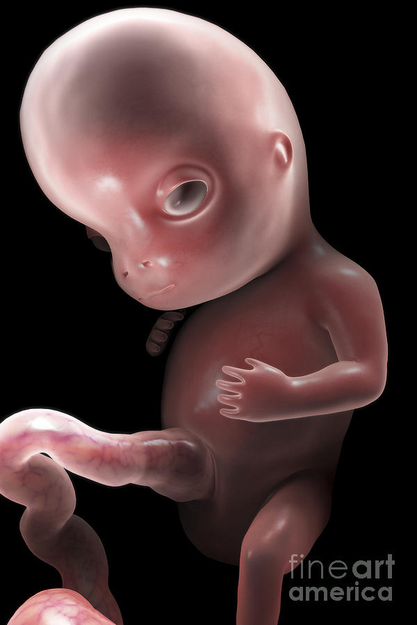 Developing Fetus Week10 #1 Photograph by Science Picture Co