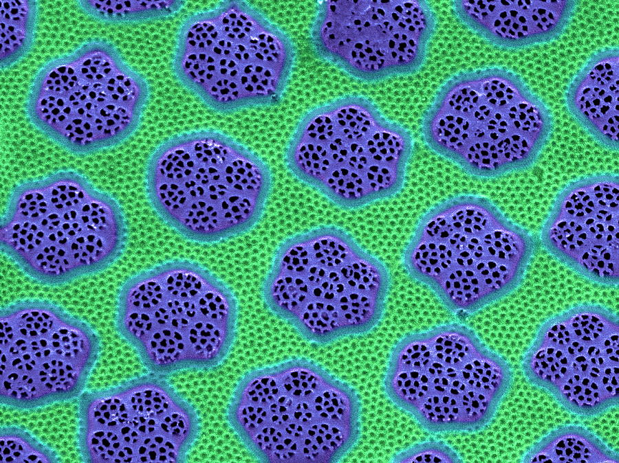 Diatom Cell Wall #1 Photograph by Steve Gschmeissner