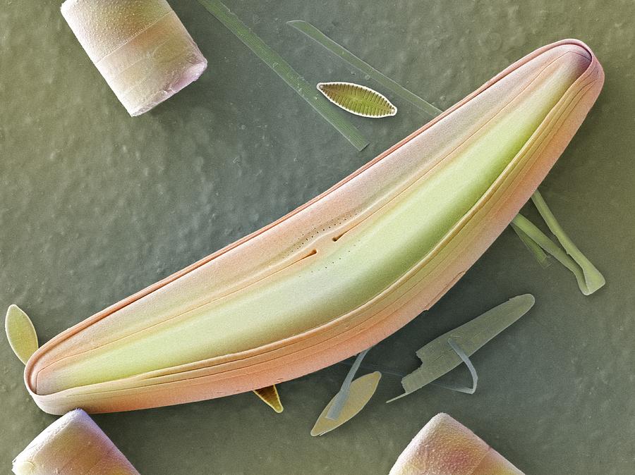 Alga Photograph - Diatom frustules (SEM) #1 by Science Photo Library