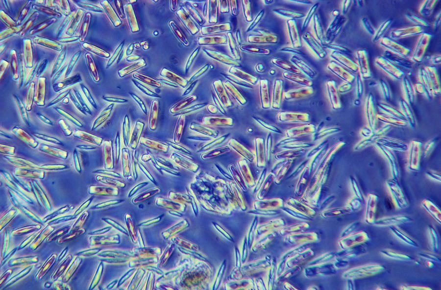 Diatoms And Algae Lm Photograph by Tom Branch - Pixels