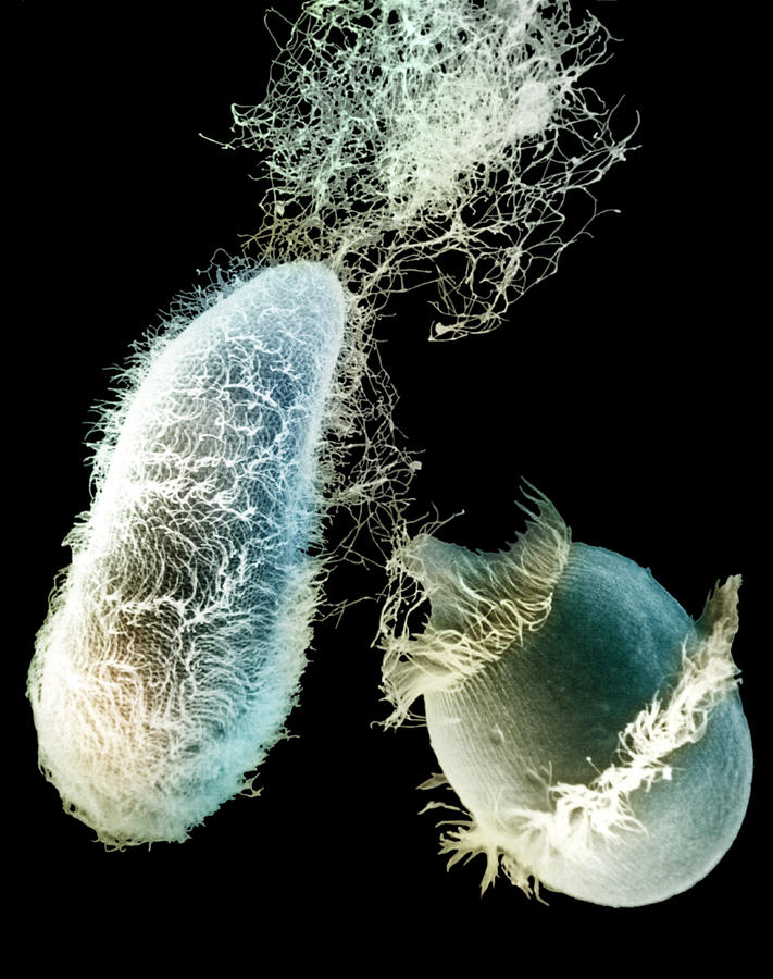 Didinium Attacking Paramecium 1 Of 5 #1 Photograph by Greg Antipa