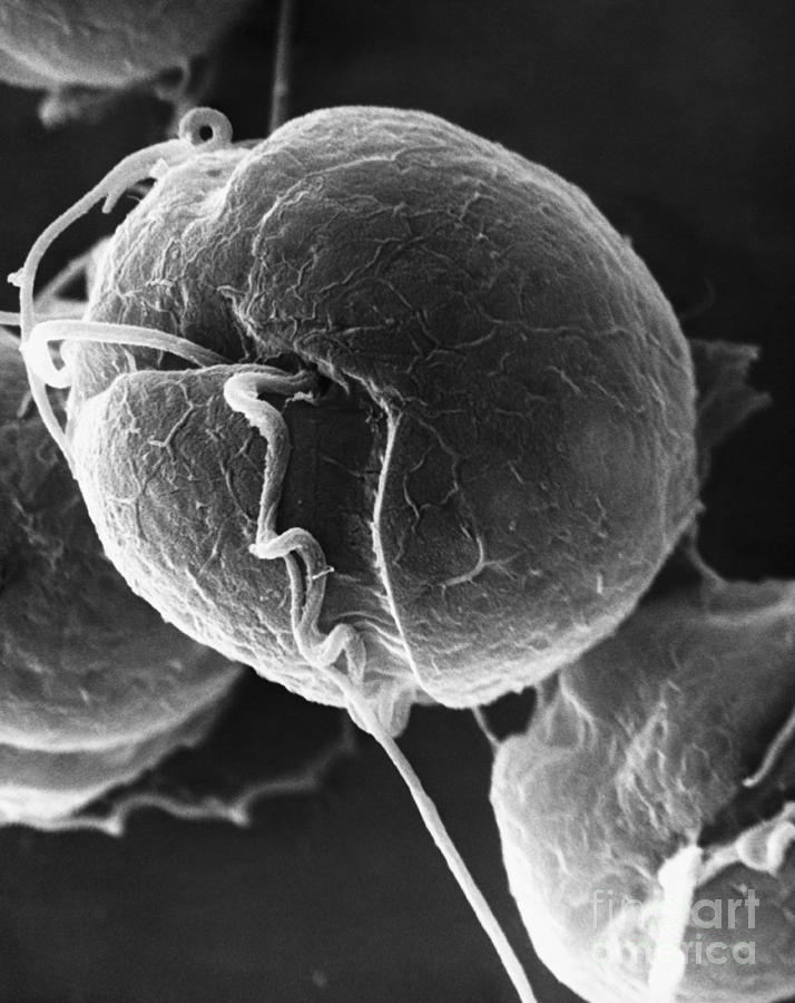 Algae Photograph - Dinoflagellate, Sem #1 by David M. Phillips