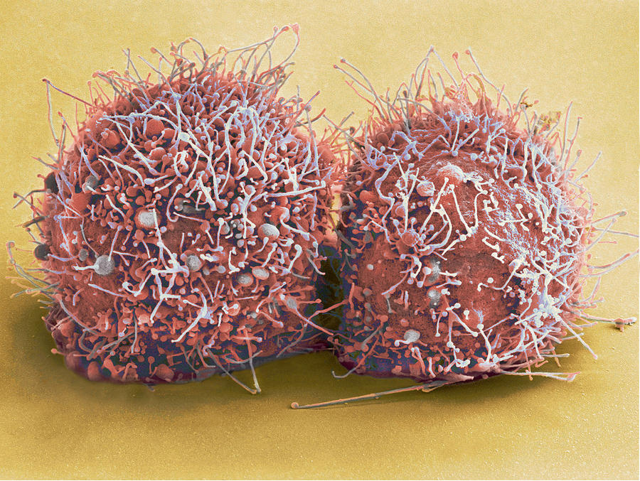 Dividing Hela Cells, Sem #1 Photograph by Science Source