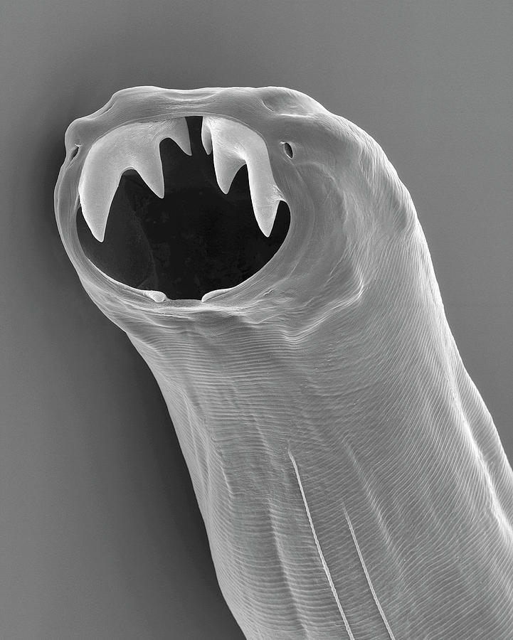 hookworms microscope