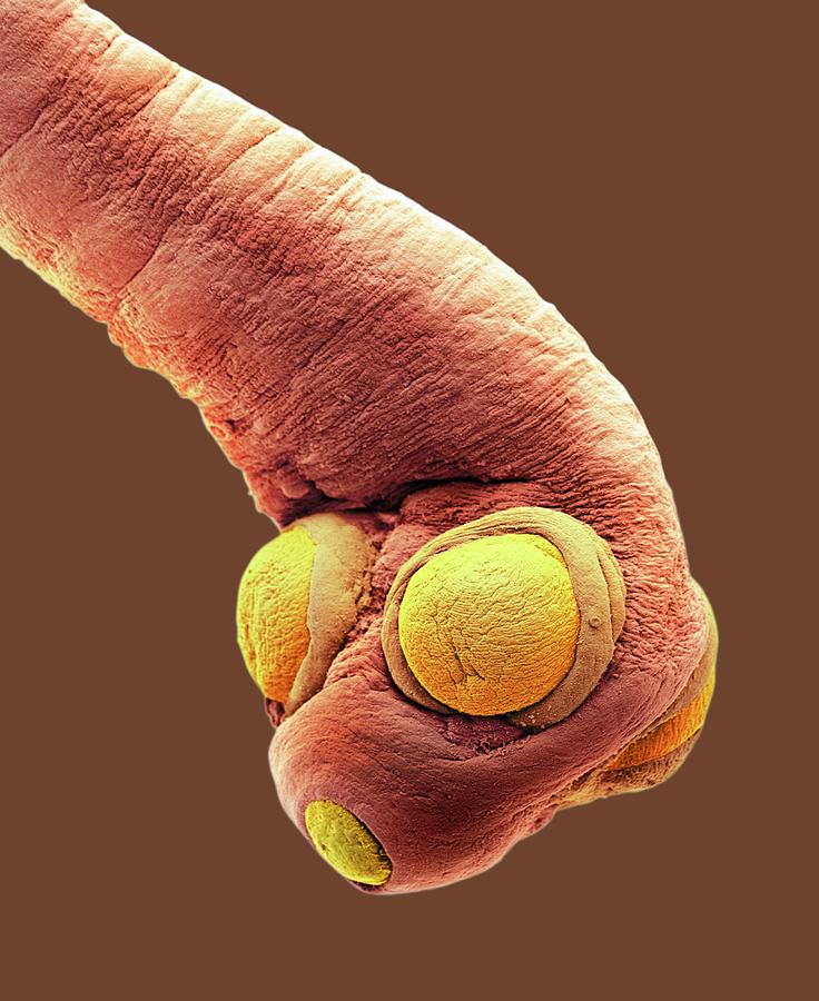 Dog Tapeworm Photograph by Steve Gschmeissner/science