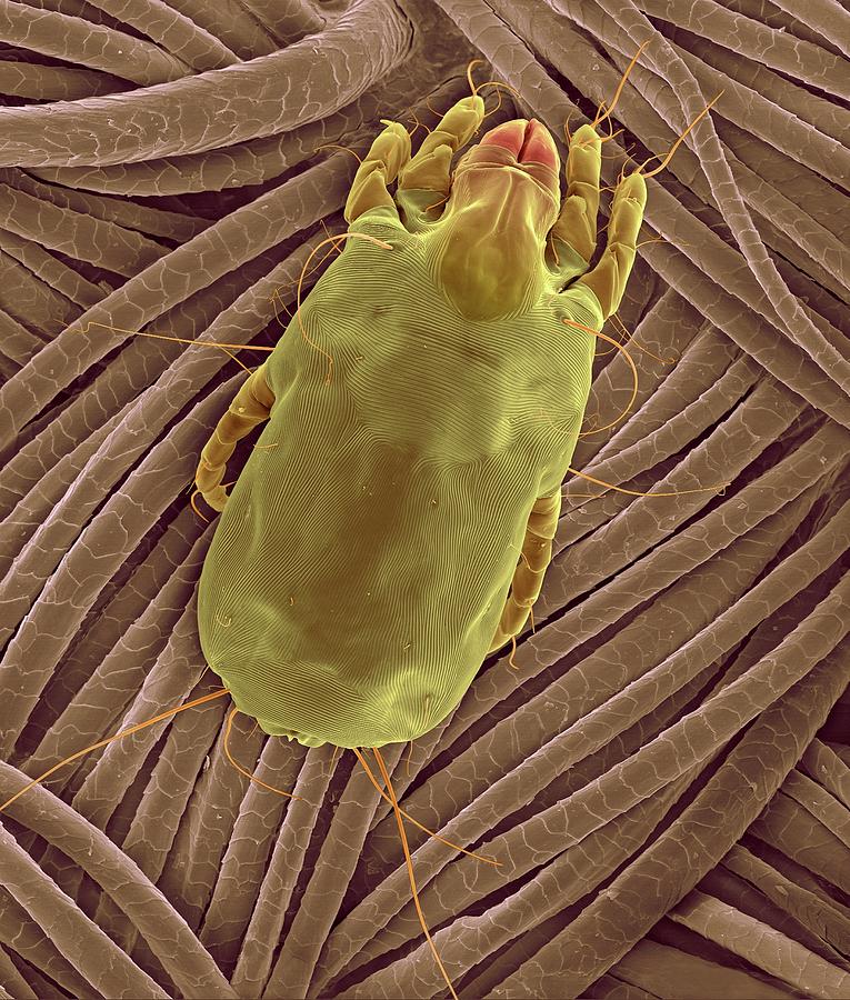 microscopic dust mites