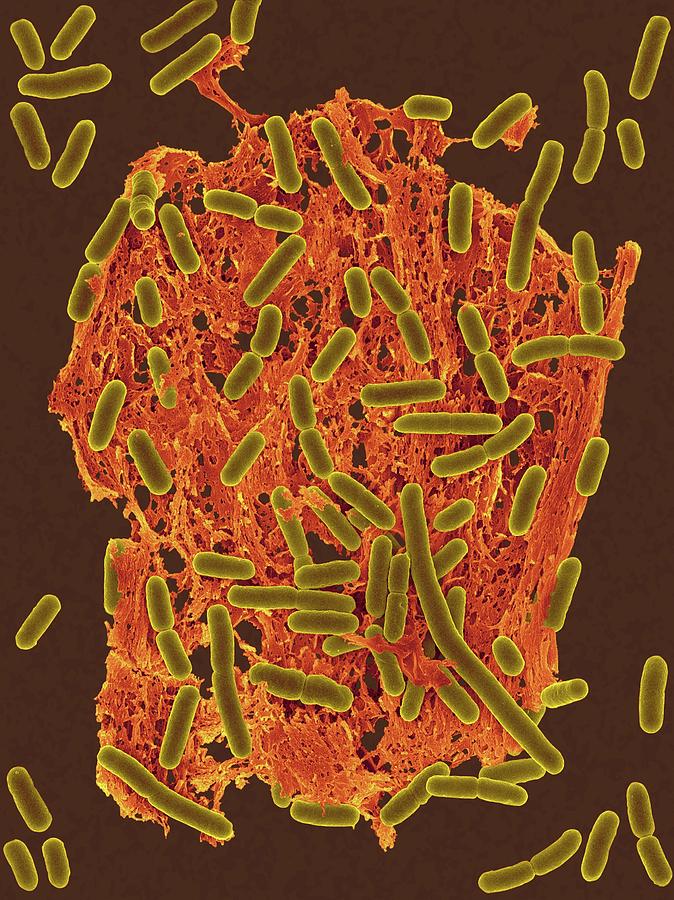 Meat Photograph - E. Coli (0157:h7) #1 by Dennis Kunkel Microscopy/science Photo Library