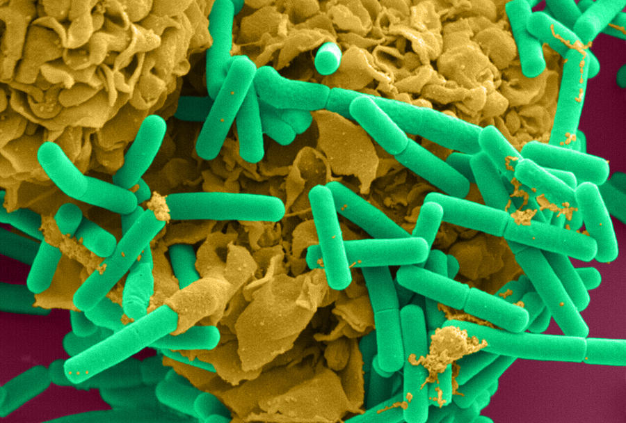 E. Coli And Macrophage Sem #1 Photograph by Science Source