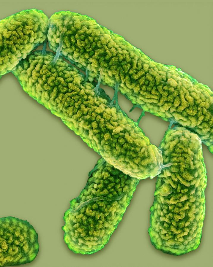 Escherichia Coli Photograph - E. Coli Bacteria #1 by Science Photo Library