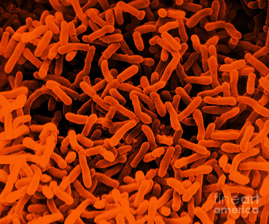 E. Coli Bacteria, Sem #1 Photograph by David M. Phillips