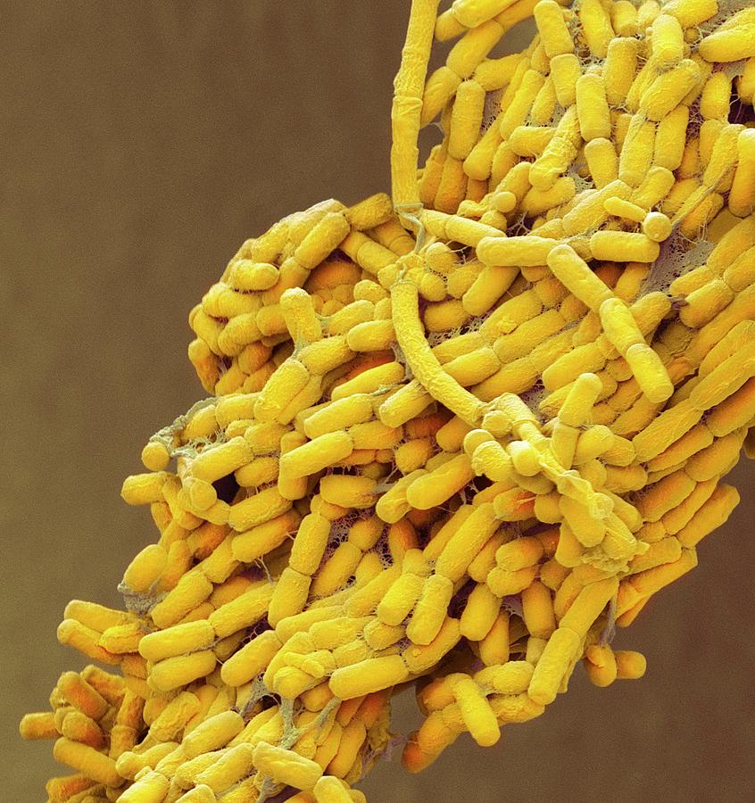 Escherichia Coli Photograph - E. Coli Bacteria #1 by Steve Gschmeissner