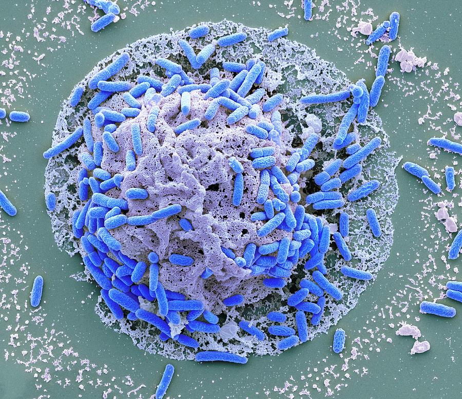 E. Coli Induced Cell Death #1 Photograph by Steve Gschmeissner
