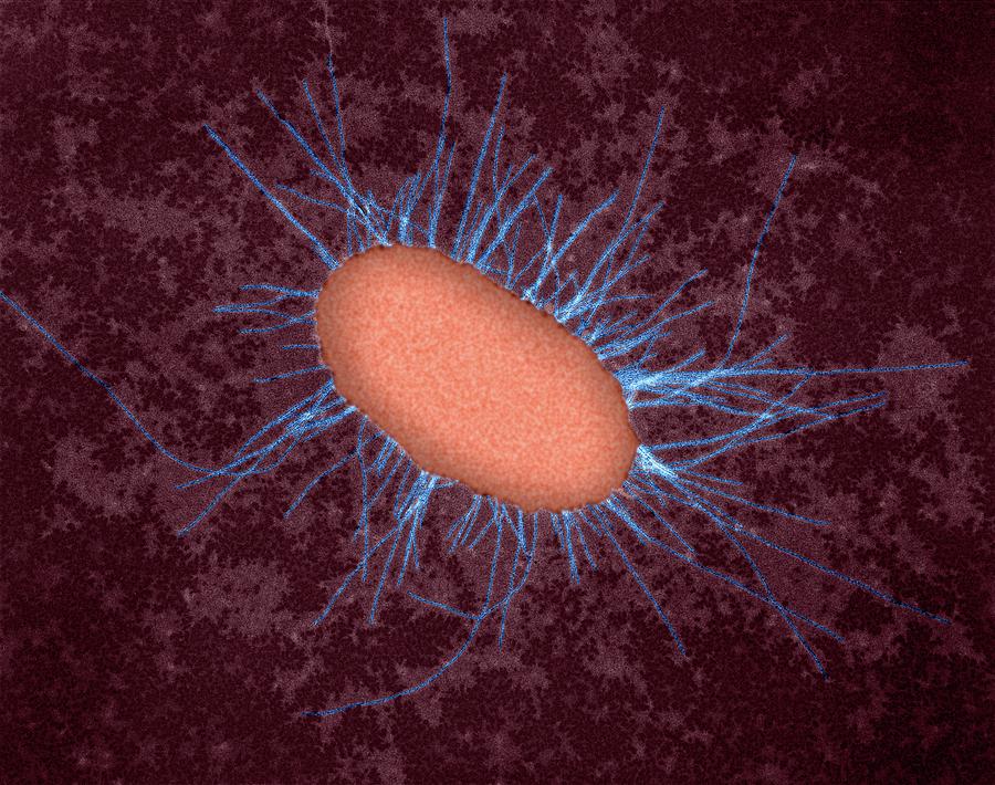 E Coli With Fimbriae Photograph By Dennis Kunkel Microscopyscience Photo Library Fine Art 9123