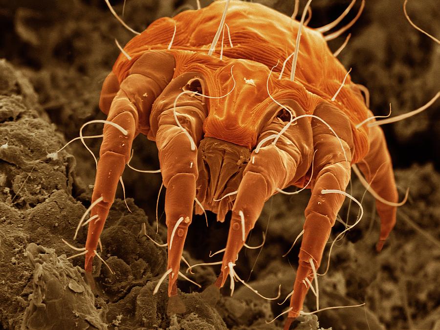 Ear Mite (otodectes Cynotis) #1 Photograph by Power And Syred