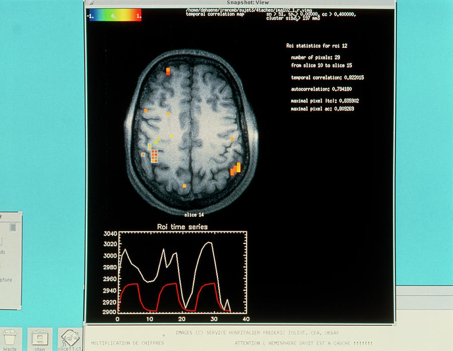 Eeg Of Brain Activity During Mathematical Thought #1 Photograph by Pascal Goetgheluck/science Photo Library