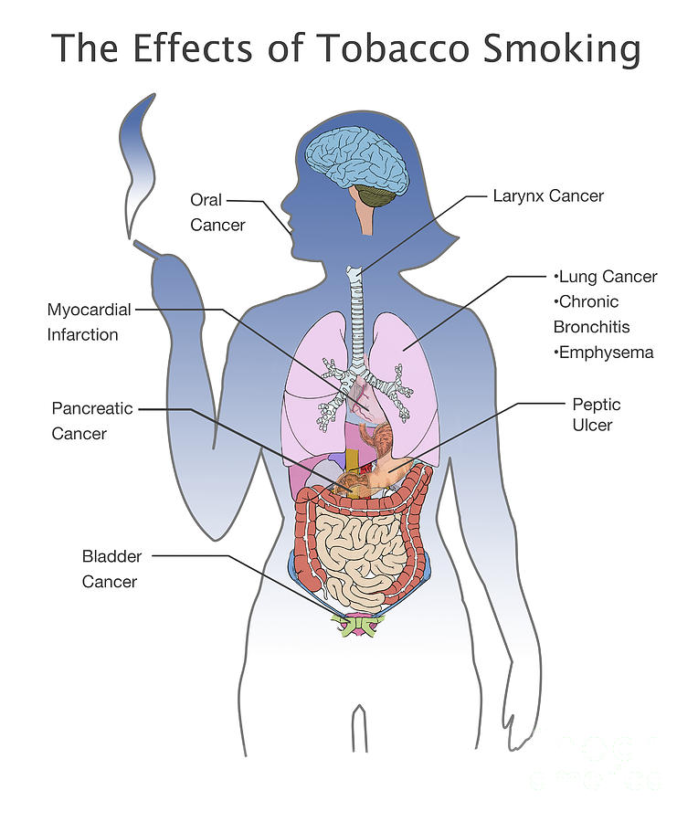 Effects Of Tobacco Smoking #1 Photograph by Spencer Sutton