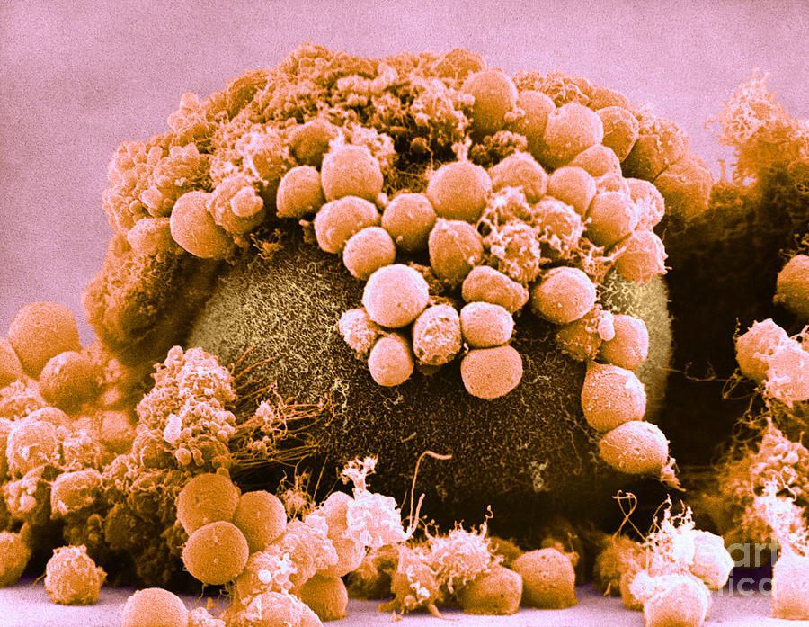 Egg And Cumulus Cells, Sem #1 Photograph by David M. Phillips