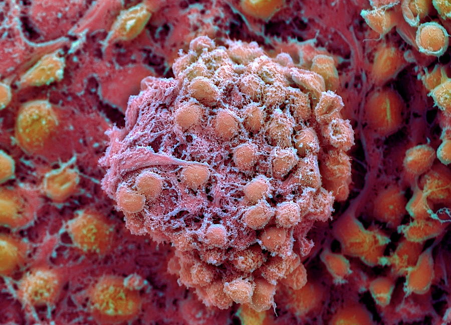 Ball Photograph - Embryonic Stem Cells #1 by Professor Miodrag Stojkovic/science Photo Library